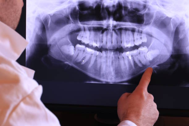 Best Weekend Emergency Dentist in Lockport, IL